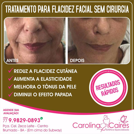 Carolina Caires - Estética Especializada: se livre da flacidez facial