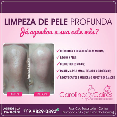 Carolina Caires Estética Especializada - Tenha uma pela mais jovem e saudável