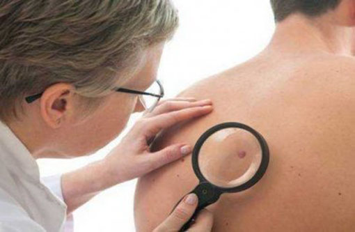 Uneb estuda a epidermólise bolhosa hereditária após muitos casos serem registrados em Barra da Estiva e Vitória da Conquista