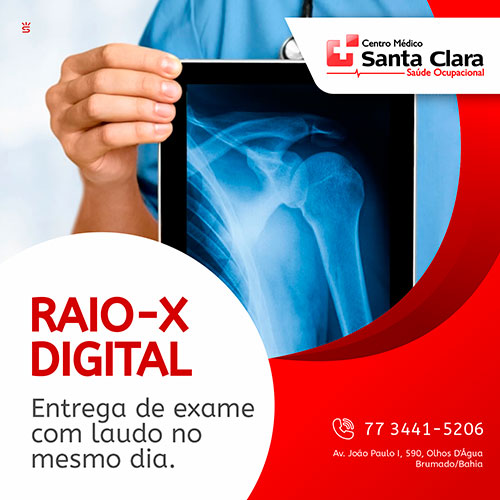 Centro Médico Santa Clara: Raio-X Digital, com entrega de exame com laudo no mesmo dia