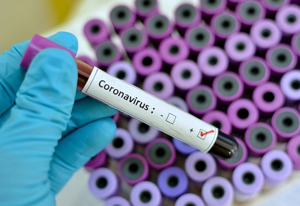 Bahia tem 437 confirmações da Covid-19