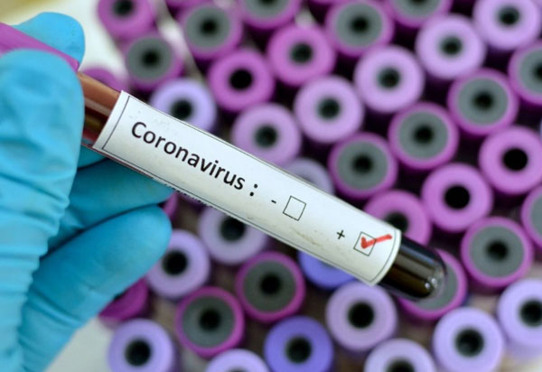 Bahia tem 11.197 casos confirmados de Covid-19 e 362 óbitos