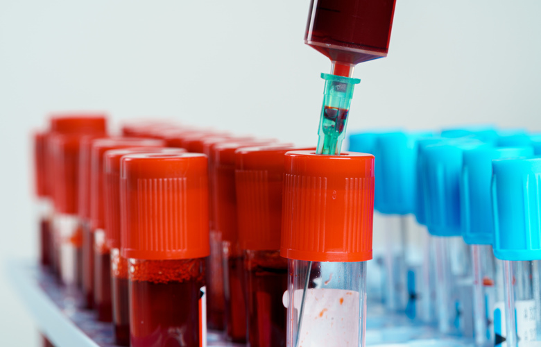 Brasil registra mais de 555 mil casos de Covid-19