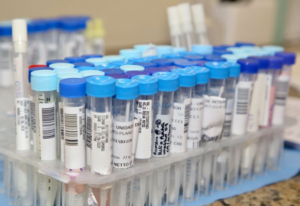 Brasil ultrapassa 45 mil mortes pela Covid-19; total de casos é de 923.189