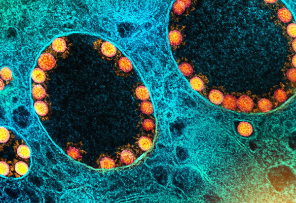 Aprovado o primeiro medicamento para tratamento da covid-19 no SUS