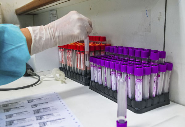 Universidades federais conduzem 1.260 pesquisas sobre covid-19