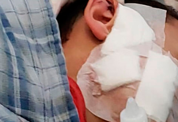 Brumado: Menino de 9 anos é atacado por pitbull no bairro Santa Tereza