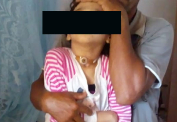 Após alergia a medicação, criança não consegue falar, andar e enxergar; família pede doações da população