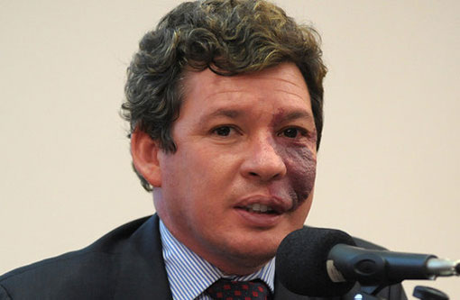 Deputado propõe fim do dinheiro em espécie no Brasil