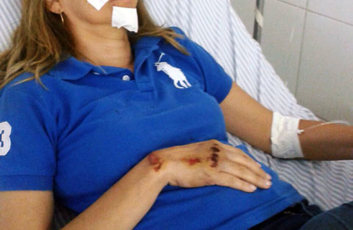 Brumado: Diretora do CMEAS sofre tentativa de assalto a caminho da escola; vítima se feriu