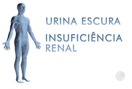 Morre segunda pessoa na Bahia com suspeita de doença que deixa urina preta 