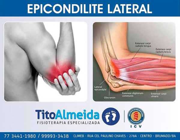 Tito Almeida - Fisioterapia Especializada