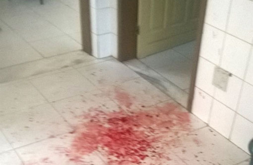 Jussiape: Após ser expulso da escola, menor atinge porteiro com golpe de facão