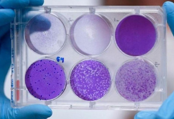 Cientistas brasileiros preparam teste de medicamento que reduz carga viral  da Covid-19 em 94%