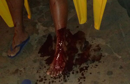 Brumado: Policial à paisana surta, ataca funcionária de uma lanchonete e fere com um facão um feirante