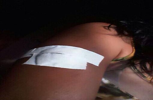 Livramento: Aluna fere colega de classe com golpes de tesoura