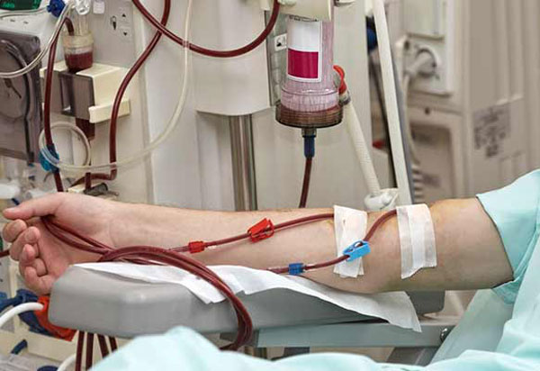 Bahia: Fechamento de fábrica da Petrobras em Camaçari impactará hemodiálise