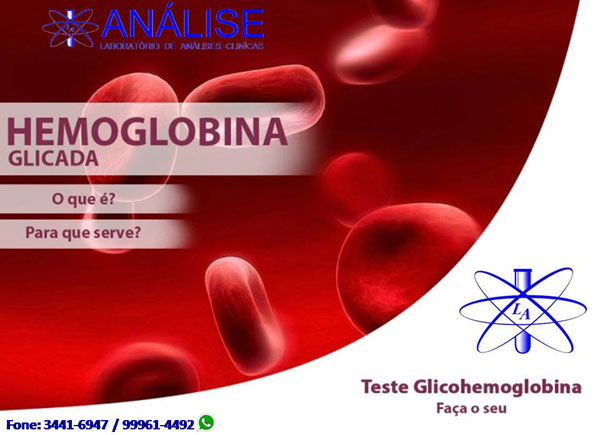 Informativo LABORATÓRIO ANÁLISE: Para que serve o exame de hemoglobina glicada?