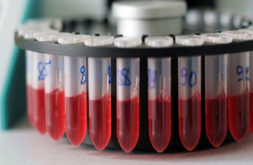 Dia Mundial de Combate às Hepatites é lembrado com alerta a doença