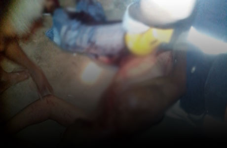 Brumado: Homem leva facada no pescoço no bairro Urbis II