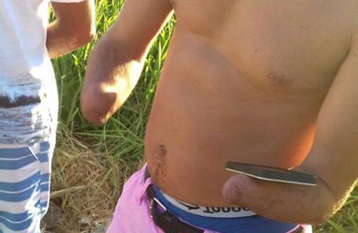 PRF flagra homem que não tinha nenhuma das mãos, dirigindo automóvel em rodovia federal na Bahia