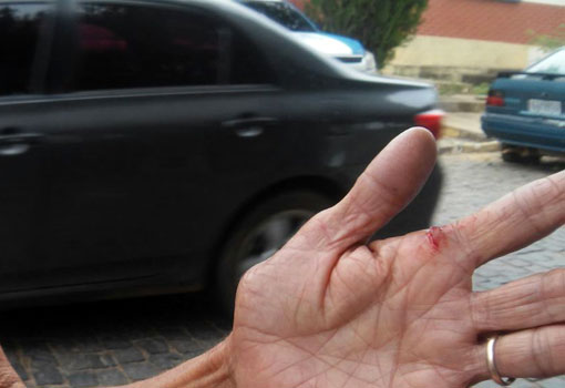 Brumado: homem tem atacado idosos na zona rural; polícia investiga os casos