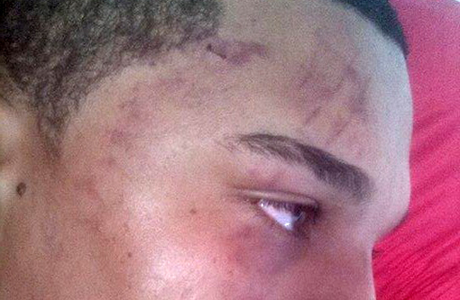 Brumado: Jovem foi agredido até ficar inconsciente; briga aconteceu na Praça da Prefeitura