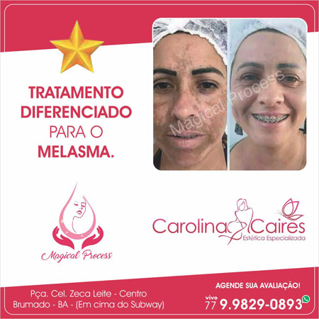 Carolina Caires - Estética Especializada: quer resultados rápidos? Conheça o Magical Process