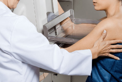 SBM alerta para o diagnóstico tardio de câncer do Câncer de Mama