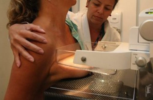 Brasileiras fazem três vezes menos mamografias do que recomenda a OMS