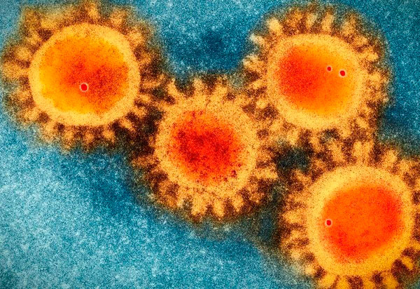 Empresa Americana diz ter encontrado anticorpo que inibe 100% a infecção pelo Coronavírus