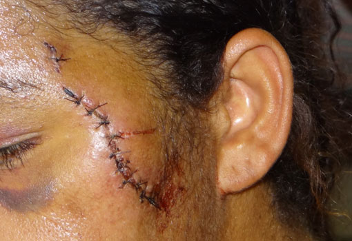 Pesquisa indica que 27% das mulheres nordestinas já sofreram violência doméstica