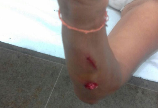 Brumado: homem é detido após agredir com  facão tia de 58 anos de idade 