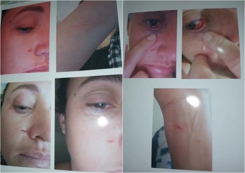 Livramento: mulher denuncia agressões físicas após cobrar pensão alimentícia ao genitor de sua filha