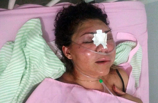 Ibiassucê: mulher foi brutalmente agredida por ex-marido