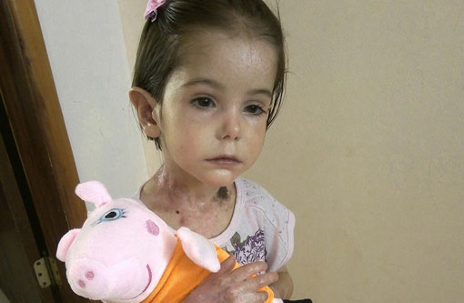 Cabeleireira faz campanha para ajudar criança com doença em Rio do Antônio