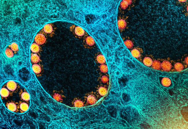 Pandemias futuras podem ser mais mortais e contagiosas, diz cientista