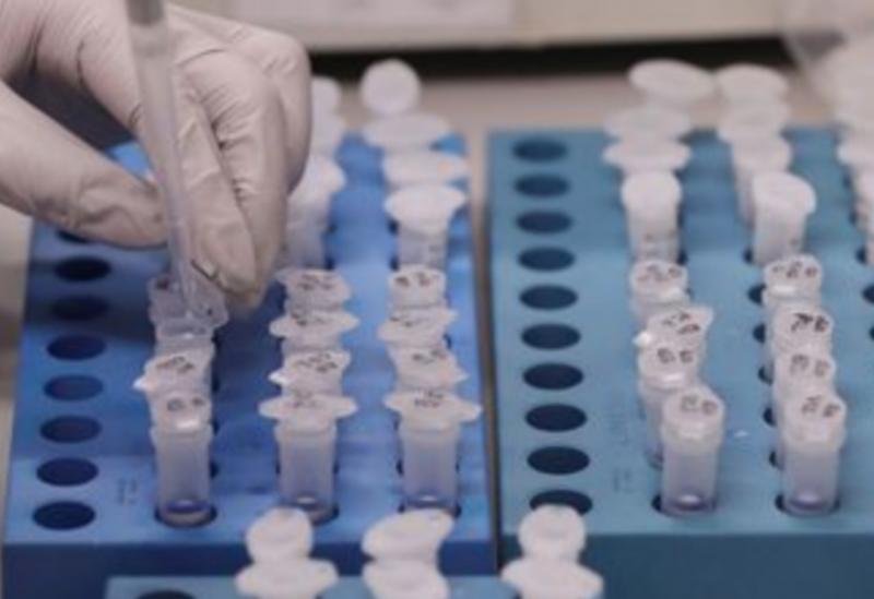 Covid-19: número de mortes chega a 4; há 428 casos confirmados no país