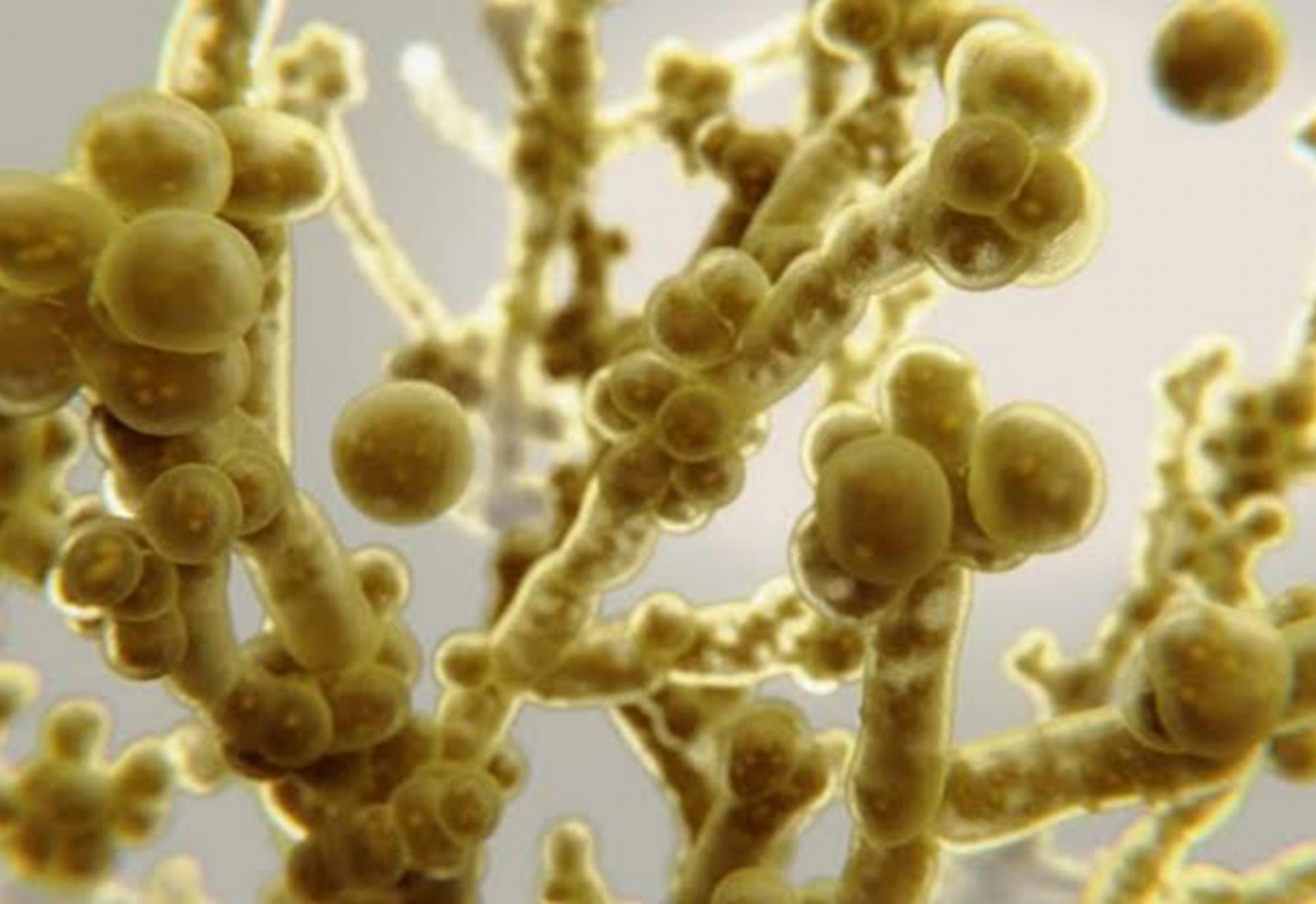 Anvisa faz alerta sobre superfungo detectado em hospital privado em Salvador