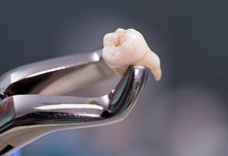 Mulher de 46 anos morre após extração de dente em clínica odontológica