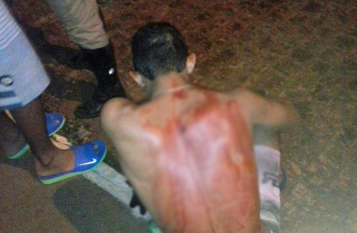 Brumado: Jovem é baleado com tiro nas costas