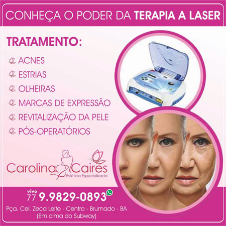 Carolina Caires - Tratamento a Laser