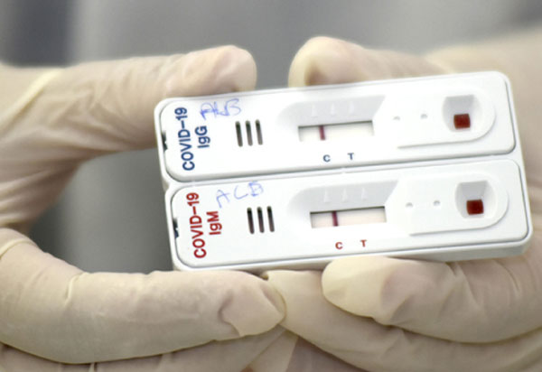 Secretaria de Saúde de Conquista disponibiliza testagem para categoria bancária