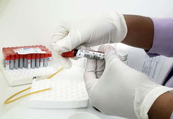 Bahia confirma transmissão comunitária da variante da Covid-19 do Reino Unido