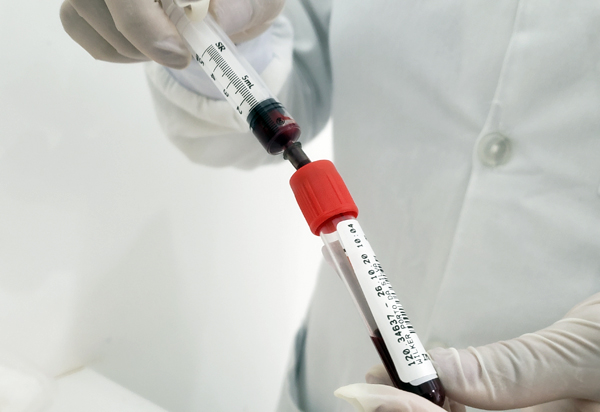 Covid-19: Brasil tem menor média móvel de mortes desde janeiro