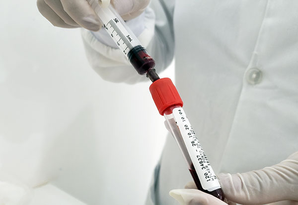 Quem já teve Covid-19 deve tomar as duas doses da vacina