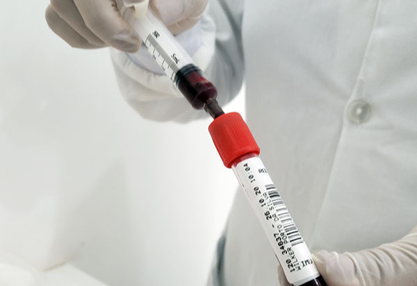 Covid-19: Casos de reinfecção investigados na Bahia são de paciente de 44 cidades