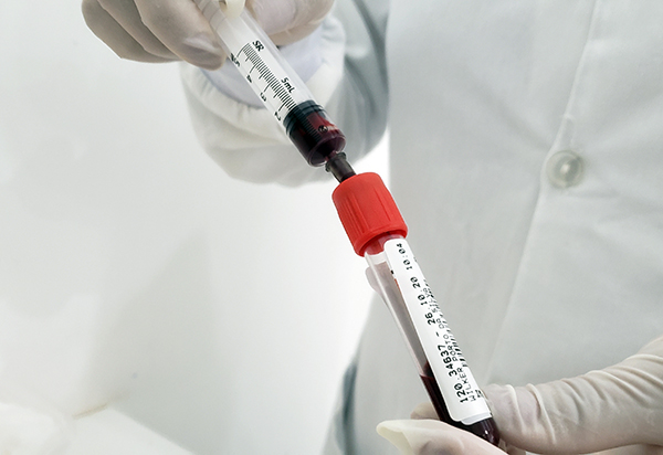 Covid-19: Bahia confirma variantes Delta e Beta e propõe antecipação da 3ª dose em 281 municípios