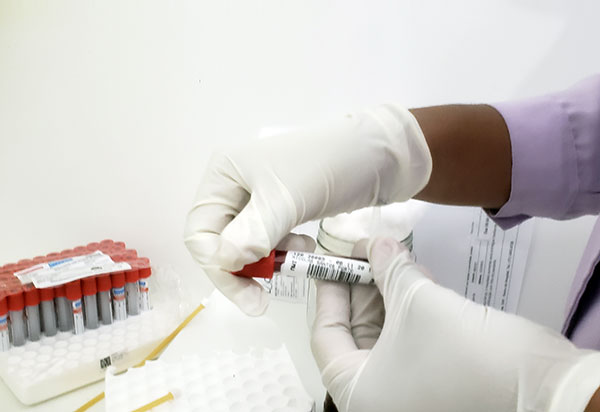 Brasil ultrapassa 7 milhões de infectados pela covid-19