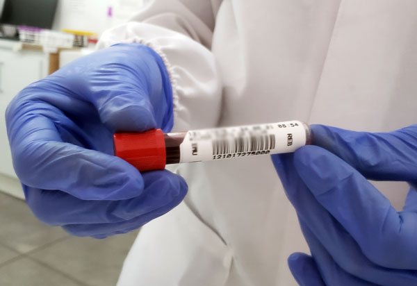 Covid-19: Brasil bate novo recorde de casos registrados em 24h